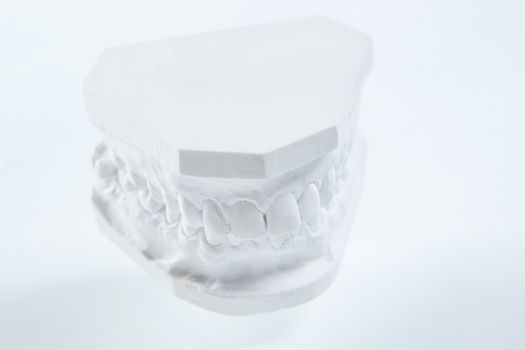 Dental casting gypsum model plaster cast stomatologic human jaws prothetic laboratory, technical shots