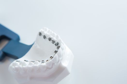 Dental lower jaw bracket braces model on white. Selective focus.