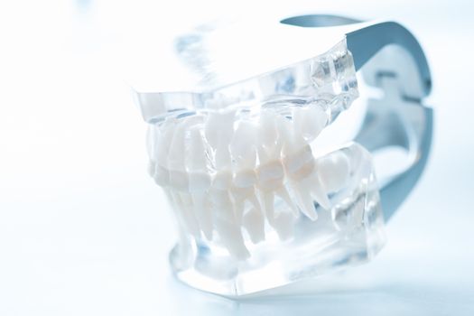 Dental model on white background. Selective focus