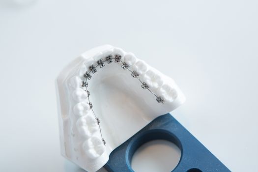 Dental lower jaw bracket braces model on white. Selective focus.