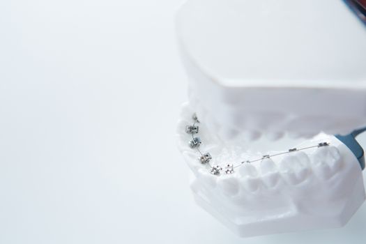 Dental lower jaw bracket braces model on white. Selective focus.