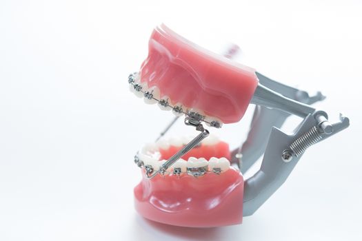 Dental lower jaw bracket braces model on white. Selective focus.