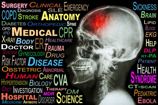X-ray skull and "Stroke" and Medical word cloud