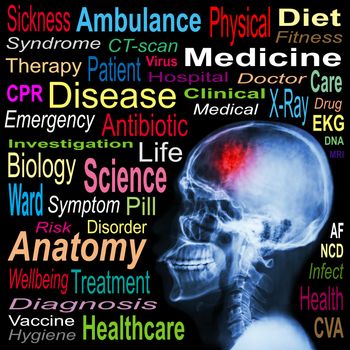 X-ray skull and "Stroke" and Medical word cloud