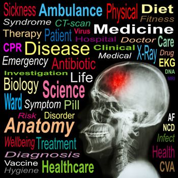 X-ray skull and "Stroke" and Medical word cloud