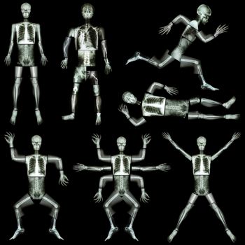 Collection of human skeleton (X-ray whole body : skull head face neck spine shoulder arm forearm elbow wrist hand finger thorax lung heart abdomen pelvis leg knee joint thigh foot ankle heel )