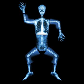 Aerobic Dance(human bone is dancing),(Whole body x-ray : head ,neck ,thorax ,shoulder ,arm ,elbow ,forearm ,hand ,finger ,joint ,thorax ,abdomen ,back,pelvis ,hip ,thigh ,leg ,knee ,foot ,heel ,ankle)