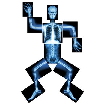 Aerobic Dance(human bone is dancing),(Whole body x-ray : head ,neck ,thorax ,shoulder ,arm ,elbow ,forearm ,hand ,finger ,joint ,thorax ,abdomen ,back,pelvis ,hip ,thigh ,leg ,knee ,foot ,heel ,ankle)