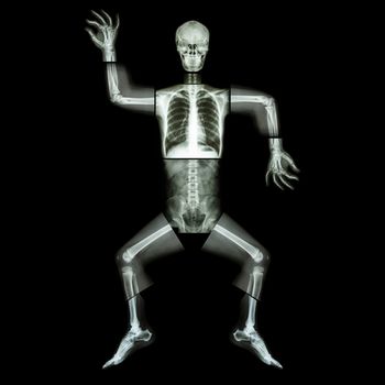 Aerobic Dance(human bone is dancing),(Whole body x-ray : head ,neck ,thorax ,shoulder ,arm ,elbow ,forearm ,hand ,finger ,joint ,thorax ,abdomen ,back,pelvis ,hip ,thigh ,leg ,knee ,foot ,heel ,ankle)