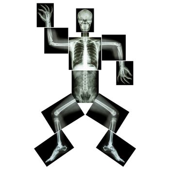 Aerobic Dance(human bone is dancing),(Whole body x-ray : head ,neck ,thorax ,shoulder ,arm ,elbow ,forearm ,hand ,finger ,joint ,thorax ,abdomen ,back,pelvis ,hip ,thigh ,leg ,knee ,foot ,heel ,ankle)