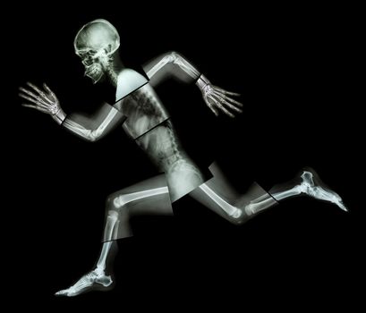 Marathon (human bone is running) ,(Whole body x-ray : head ,neck ,shoulder ,arm ,elbow ,forearm ,hand ,finger ,joint ,thorax ,abdomen ,back,pelvis ,hip ,thigh ,leg ,knee ,foot ,heel)