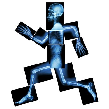 Aerobic Exercise (human bone is running) ,(Whole body x-ray : head ,neck ,shoulder ,shoulder ,arm ,elbow ,forearm ,hand ,finger ,joint ,thorax ,abdomen ,back,pelvis ,hip ,thigh ,leg ,knee ,foot ,heel)