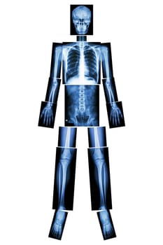 Anatomical Position. (X-ray whole body : head ,neck ,thorax ,heart ,lung ,rib ,shoulder ,scapula ,arm ,forearm ,elbow ,wrist ,hand ,digit ,abdomen ,hip ,pelvic ,leg ,thigh ,knee ,ankle ,heel ,foot )