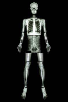 Anatomical Position. (X-ray whole body : head ,neck ,thorax ,heart ,lung ,rib ,shoulder ,scapula ,arm ,forearm ,elbow ,wrist ,hand ,digit ,abdomen ,hip ,pelvic ,leg ,thigh ,knee ,ankle ,heel ,foot )