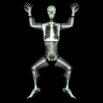 Jigsaw human x-ray ( whole body : head skull face neck spine shoulder arm elbow joint forearm wrist hand finger chest thorax heart lung rib abdomen back pelvis hip thigh knee leg ankle foot heel toe )