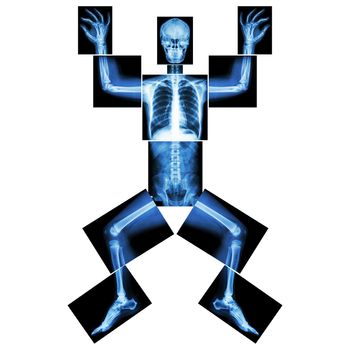 Jigsaw human x-ray ( whole body : head skull face neck spine shoulder arm elbow joint forearm wrist hand finger chest thorax heart lung rib abdomen back pelvis hip thigh knee leg ankle foot heel toe )