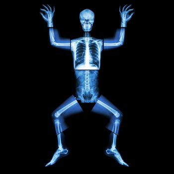 Jigsaw human x-ray ( whole body : head skull face neck spine shoulder arm elbow joint forearm wrist hand finger chest thorax heart lung rib abdomen back pelvis hip thigh knee leg ankle foot heel toe )