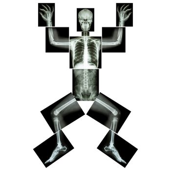 Jigsaw human x-ray ( whole body : head skull face neck spine shoulder arm elbow joint forearm wrist hand finger chest thorax heart lung rib abdomen back pelvis hip thigh knee leg ankle foot heel toe )