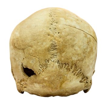 Human Skull Fracture (backside) (Mongoloid,Asian) on isolated background