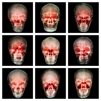 Collection of asian's skull