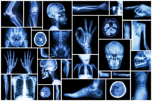 Collection X-ray multiple part of human