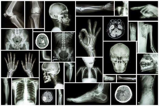 Collection X-ray multiple part of human