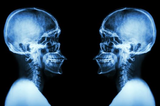 X-ray Skull and cervical spine