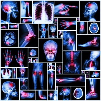 Collection X-ray multiple organ and arthritis at multiple joint (Rheumatoid,Gout)