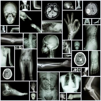 X-ray multiple part of human