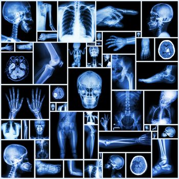 Collection X-ray multiple part of human