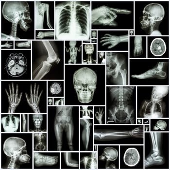 Collection X-ray multiple part of human