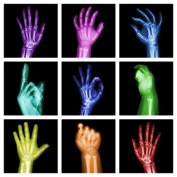 Collection of colorful x-ray hands