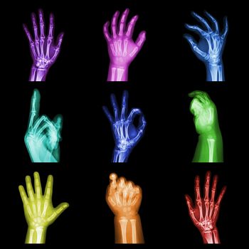 Collection of colorful x-ray hands