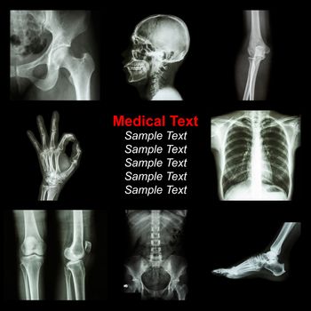 Collection of X-ray part of human