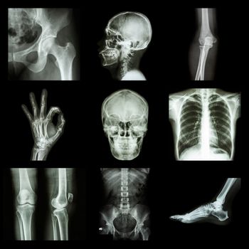Collection X-ray part of human
