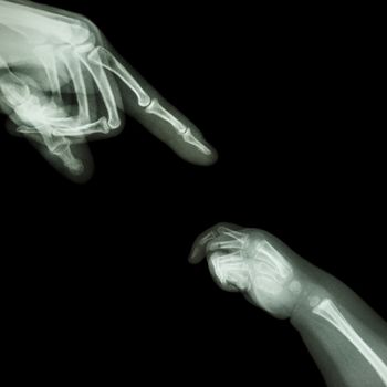 X-ray adult's hand point finger at upper side and baby's hand at lower side