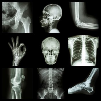 Collection X-ray part of human