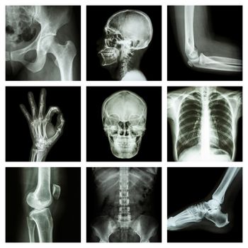 Collection X-ray part of human