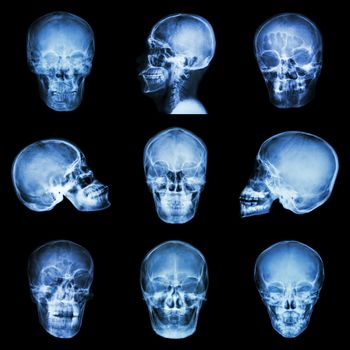 Collection of asian skull