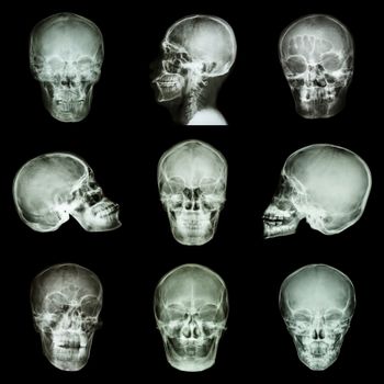 Collection of asian skull