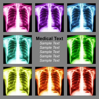 Multicolored chest x-ray background