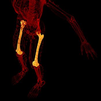 3d render medical illustration of the femur bone - top view