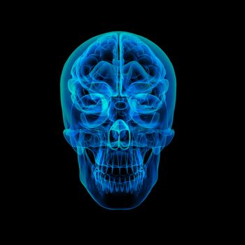 Human brain X ray - front view