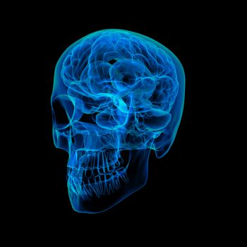 Human brain X ray - side view