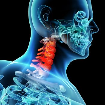 3d rendered illustration - pain neck