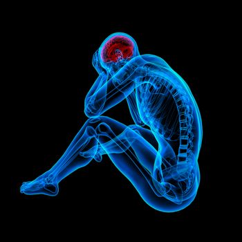 3d rendered blue skeleton of a sitting - headache - side view
