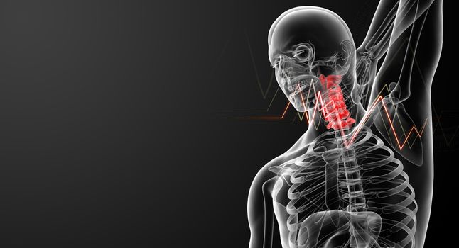 3d rendered illustration - pain neck