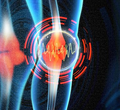 Human knee pain with the anatomy of a skeleton leg
