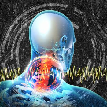3d rendered illustration - painful neck