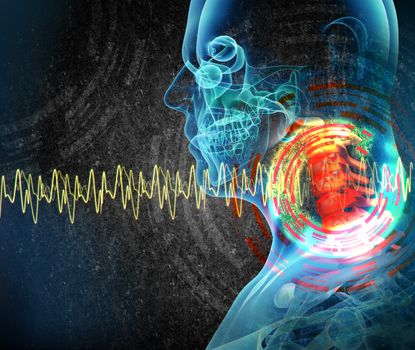 3d rendered illustration - painful neck